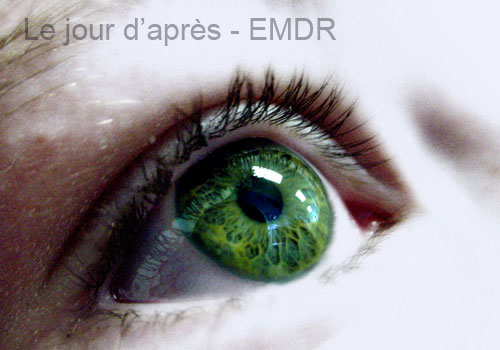 EMDR