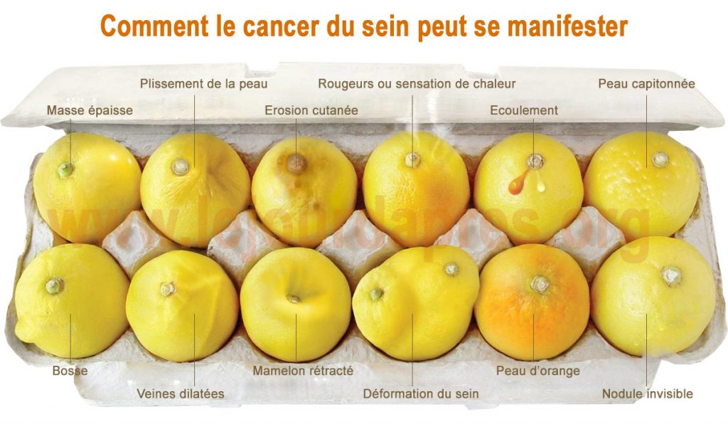 Repérer le cancer du sein grâce d’un coup d’œil grâce à ces citrons