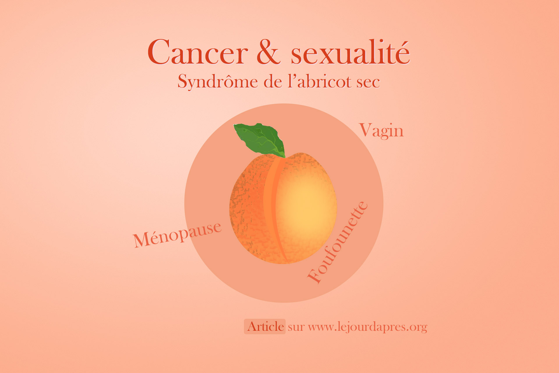 Cancer, ménopause, vagin… ou comment lutter contre le syndrôme de ...